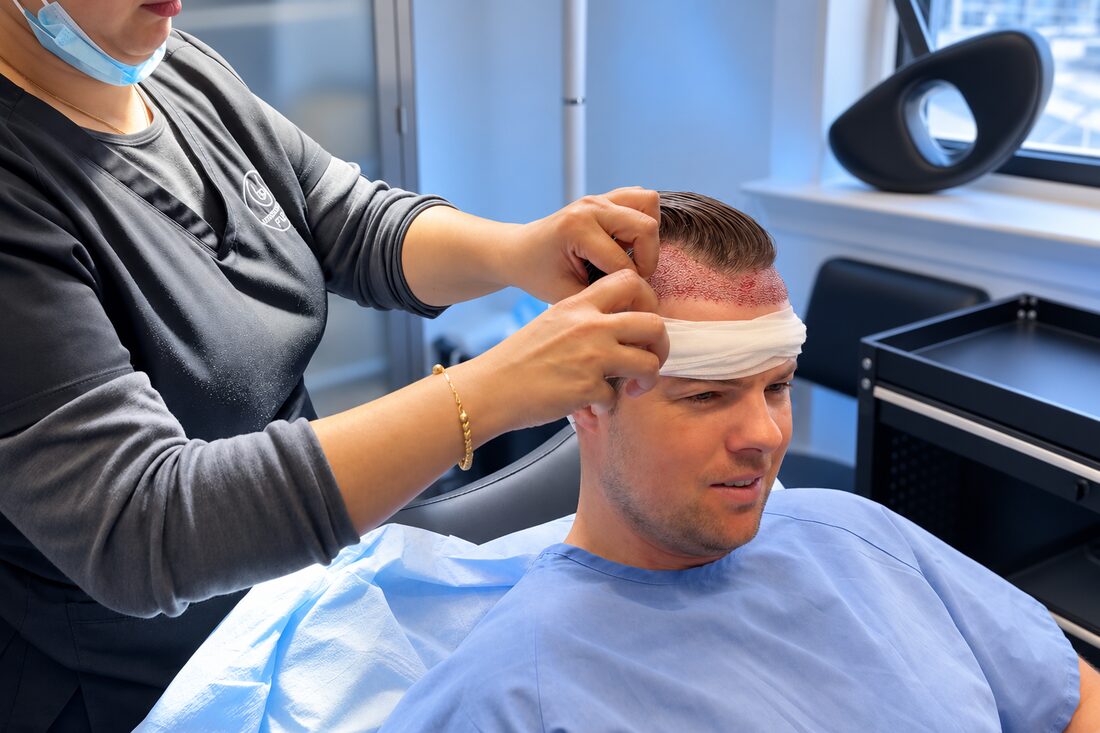 FUE hair transplant at Nova Medical Philadelphia